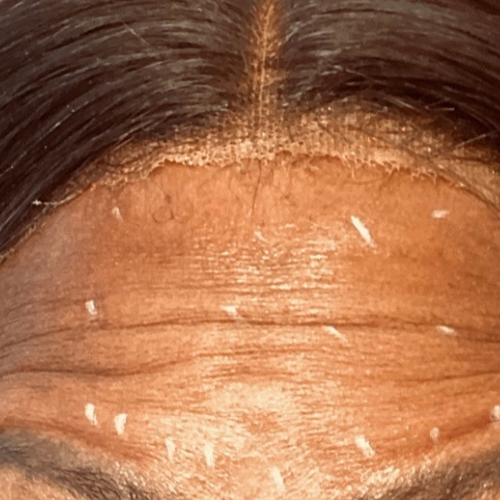 a close up of a persons face