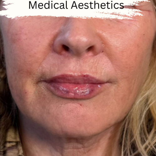 a close up of a woman