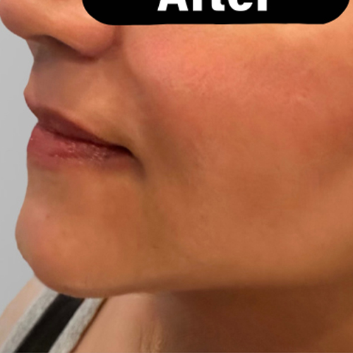 a close up of a person
