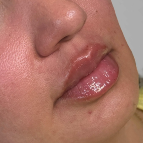 a close up of a person with the mouth open