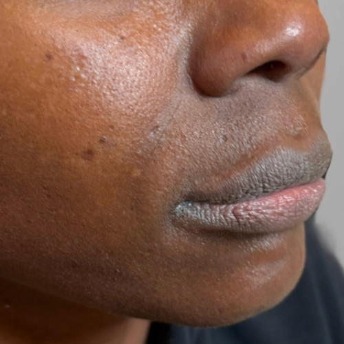 a close up of a man