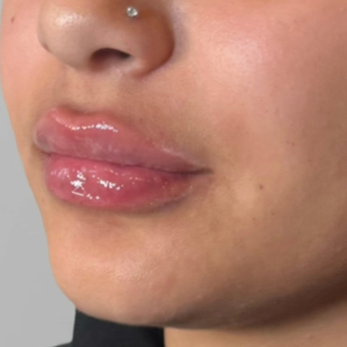 a close up of a person