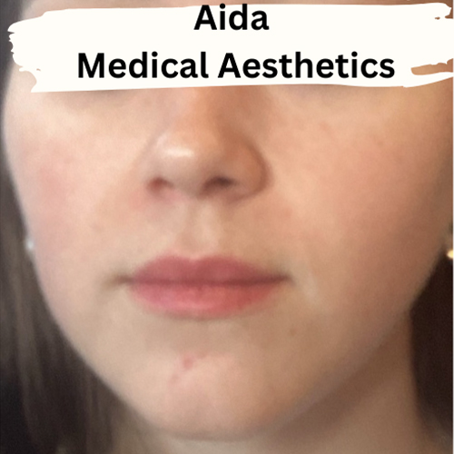 a close up of a woman