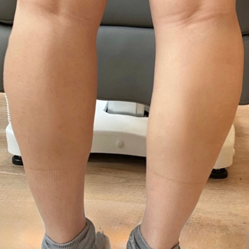 a close up of legs