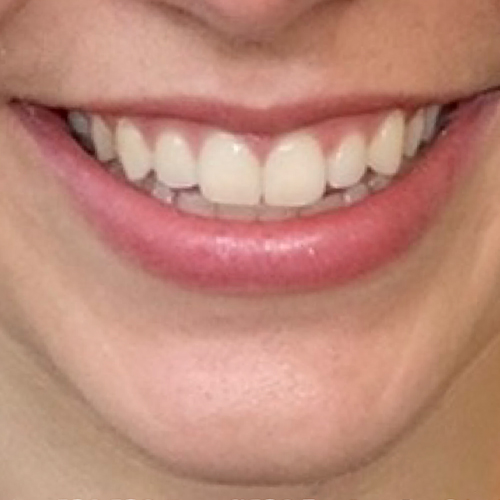 a close up of a person wearing glasses