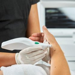 A clinician in gloves uses a handheld device to treat a patient's forearm skin in a medical clinic